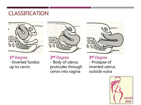 Exploration of the mothers uterus (1